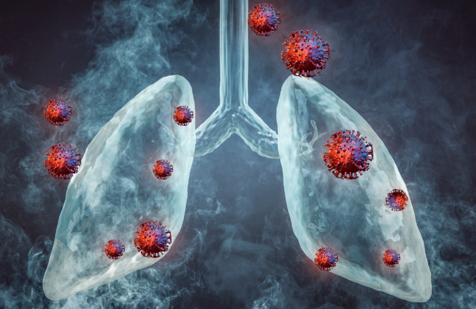 Understanding Upper Respiratory Tract Infections (URTI): 2 Common Causes of URTIs, Symptoms, and Management