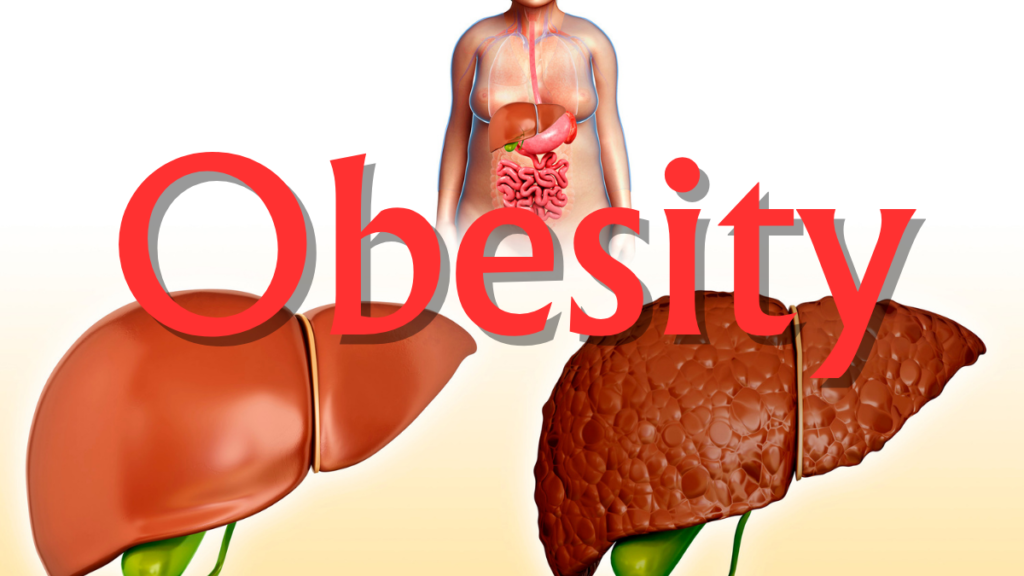 Decoding the Obesity Epidemic: Unraveling 10 Unconventional Causes (Part 2) 5 Decoding the Obesity Epidemic: Unraveling 10 Unconventional Causes (Part 2)