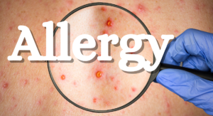 Read more about the article Unveiling the Itch: Causes, Symptoms, and Soothing Solutions