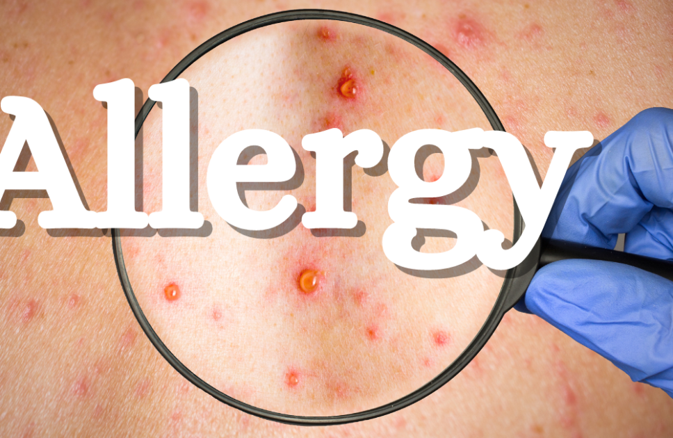 Unveiling the Itch: Causes, Symptoms, and Soothing Solutions