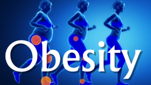 Read more about the article  Decoding the Obesity Epidemic: Unraveling 10 Unconventional Causes  (Part 2)