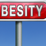  Decoding Obesity: Understanding Causes and Prevention, 99 Causes of Obesity, BMI