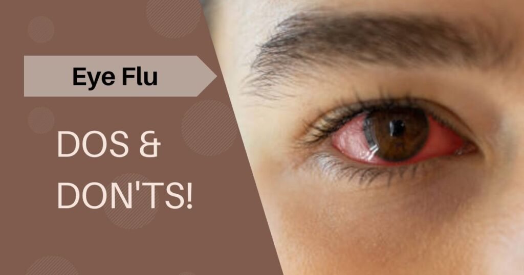 Conjunctivitis (Eye Flu) - Optimal Health 24