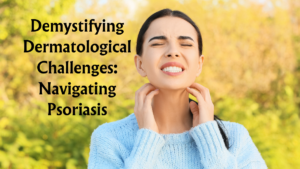 Read more about the article Demystifying Dermatological Challenges: Navigating Psoriasis (2024)
