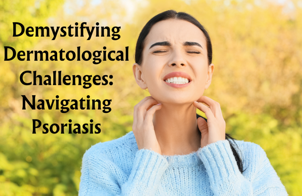 Demystifying Dermatological Challenges: Navigating Psoriasis (2024)