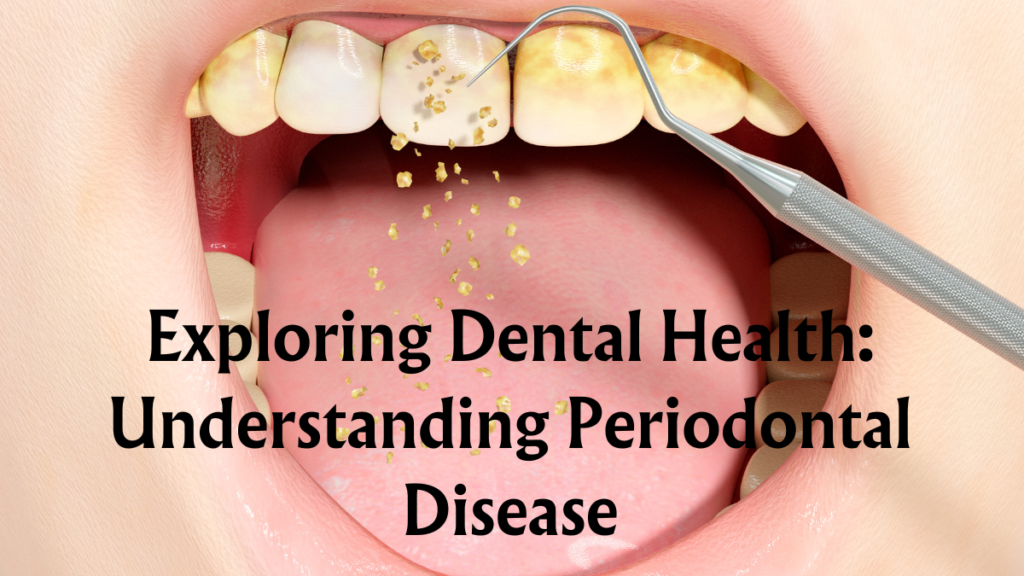 Exploring Dental Health: Understanding Periodontal Disease