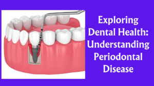 Read more about the article Exploring Dental Health: Understanding Periodontal Disease