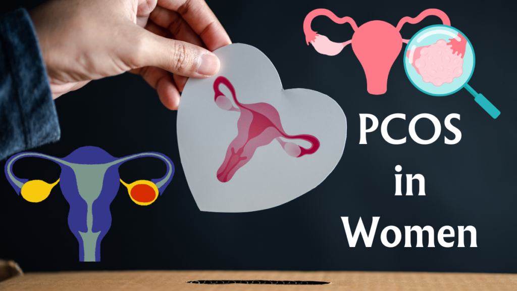 Navigating PCOS in Women and Erectile Dysfunction in Men