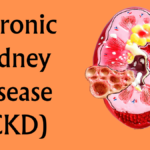 Understanding Chronic Kidney Disease (CKD)