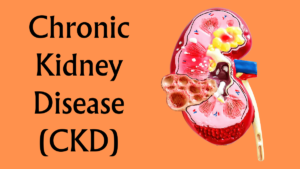 Read more about the article Understanding Chronic Kidney Disease (CKD)