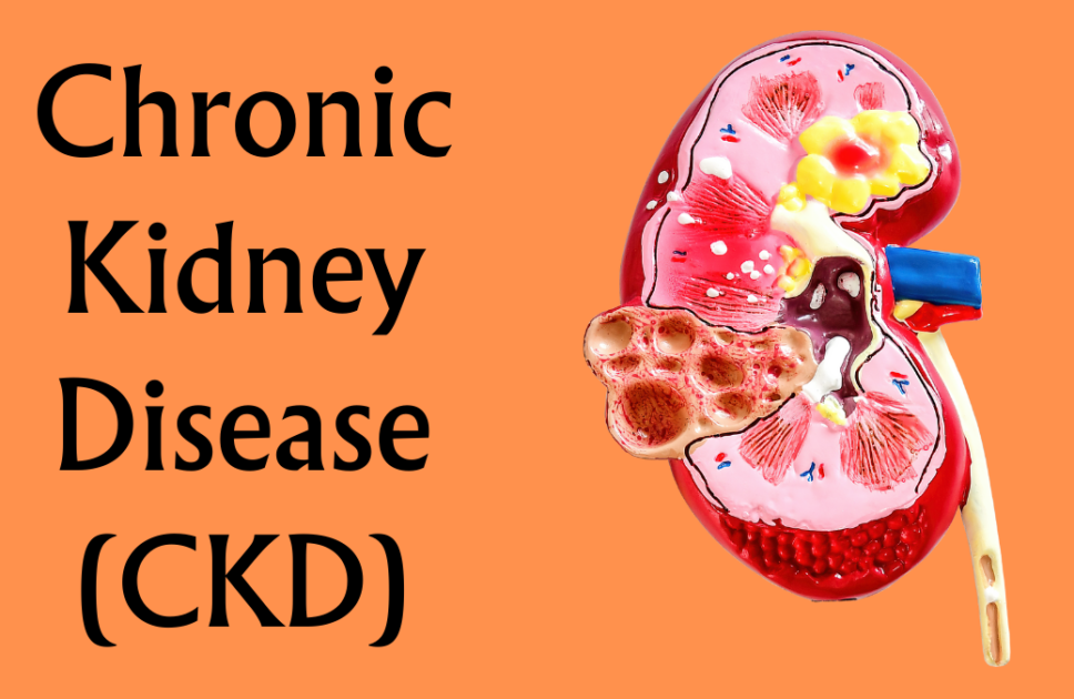 Understanding Chronic Kidney Disease (CKD)