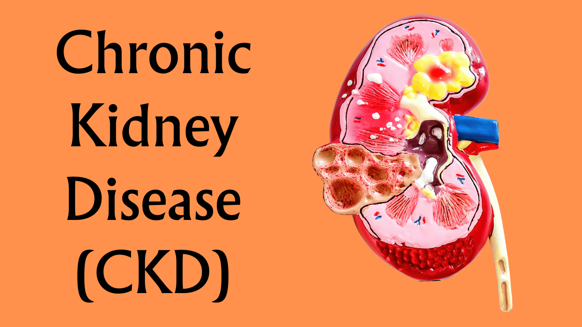 Understanding Chronic Kidney Disease (CKD)