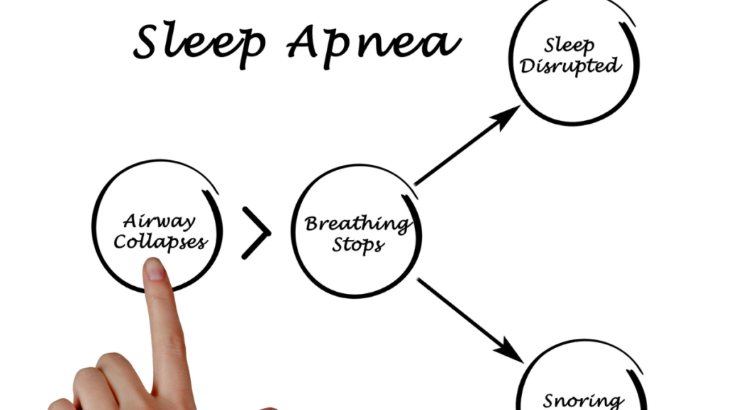 Unraveling Sleep Disruptions: Understanding Sleep Apnea