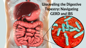 Read more about the article Digestive Tapestry: Navigating GERD and IBS