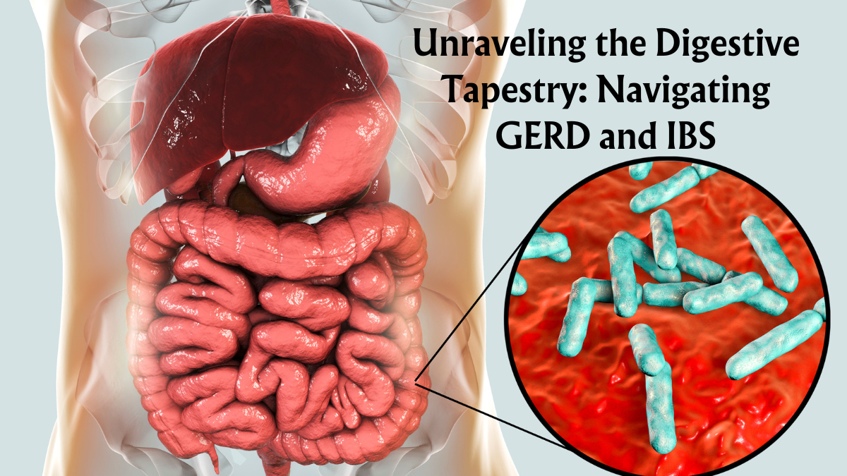 Unraveling the Digestive Tapestry: Navigating GERD and IBS