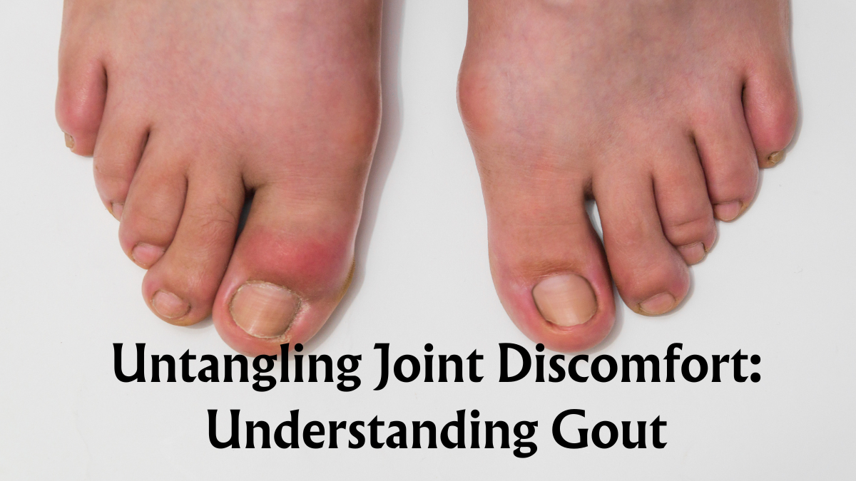 Untangling Joint Discomfort: Understanding Gout (2024), Exercise for Managing Gout